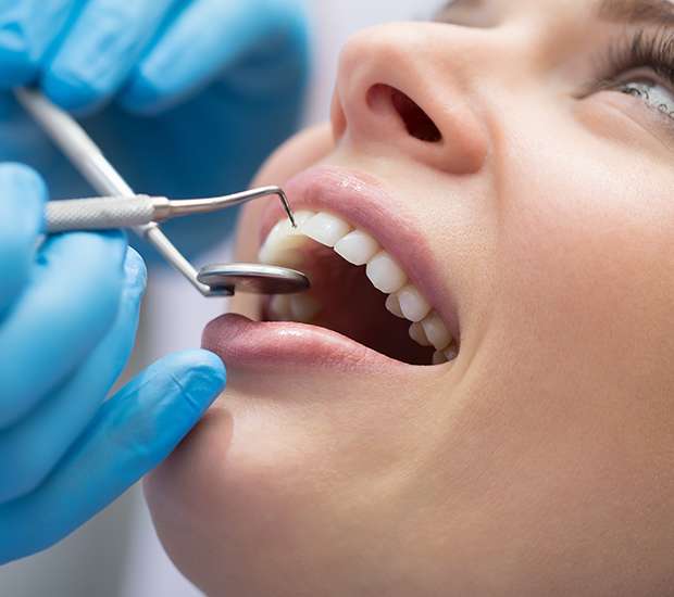 Alexandria Dental Bonding