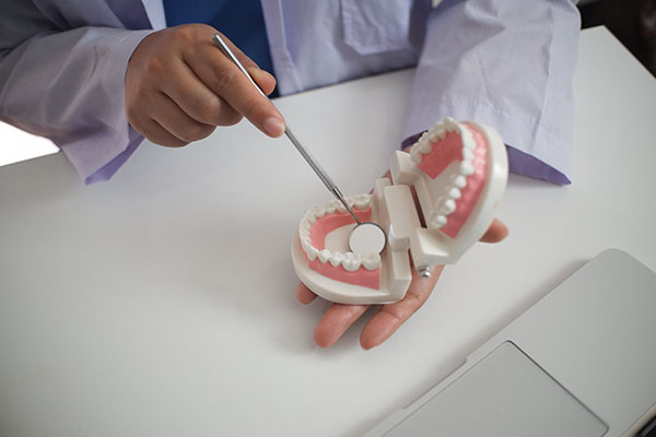 What To Do If You Damage A Dental Filling