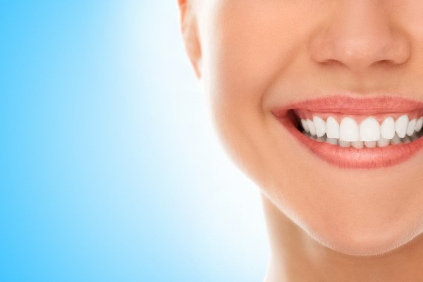 When To Consider Dental Veneers