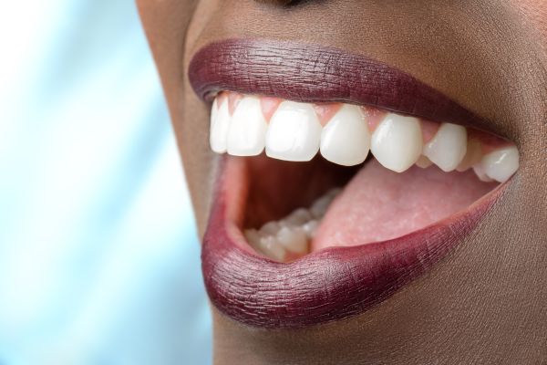 Full Mouth Reconstruction Options For Redesigning A Smile