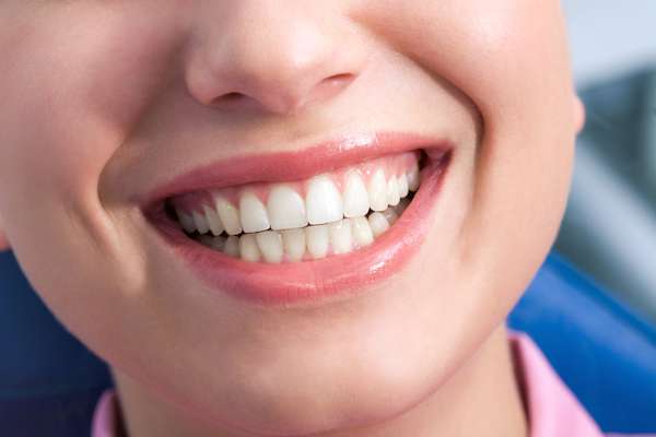 why-your-general-dentist-may-recommend-a-dental-filling-for-a-cavity