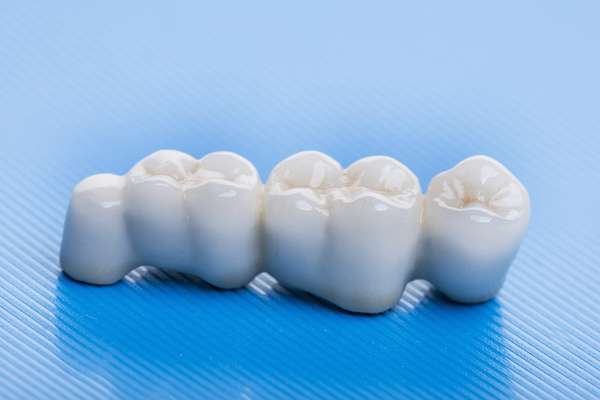 How Many Teeth Can Dental Bridges Replace from Alexandria Old Town Dental in Alexandria, VA