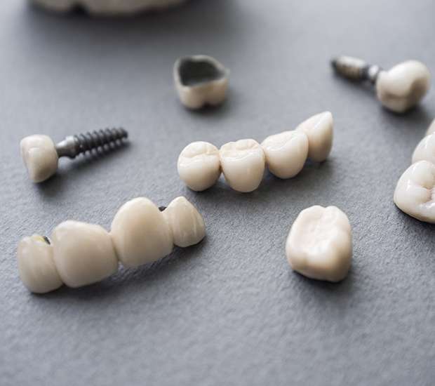 Alexandria The Difference Between Dental Implants and Mini Dental Implants
