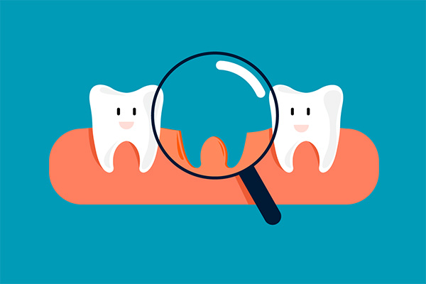 Options for Replacing Missing Teeth: What Treatments are Recommended? from Alexandria Old Town Dental in Alexandria, VA